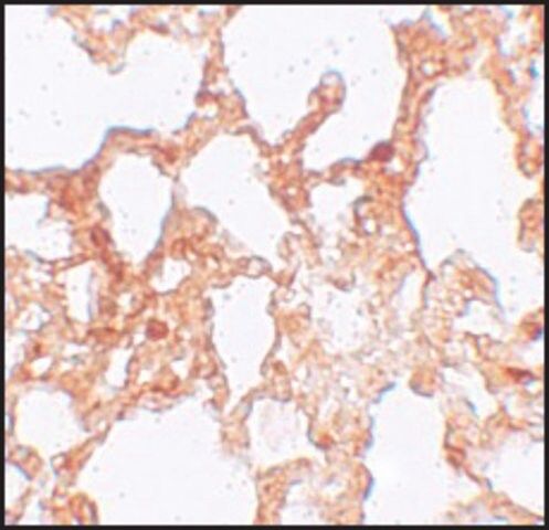 Anti-ZMYM1 antibody produced in rabbit