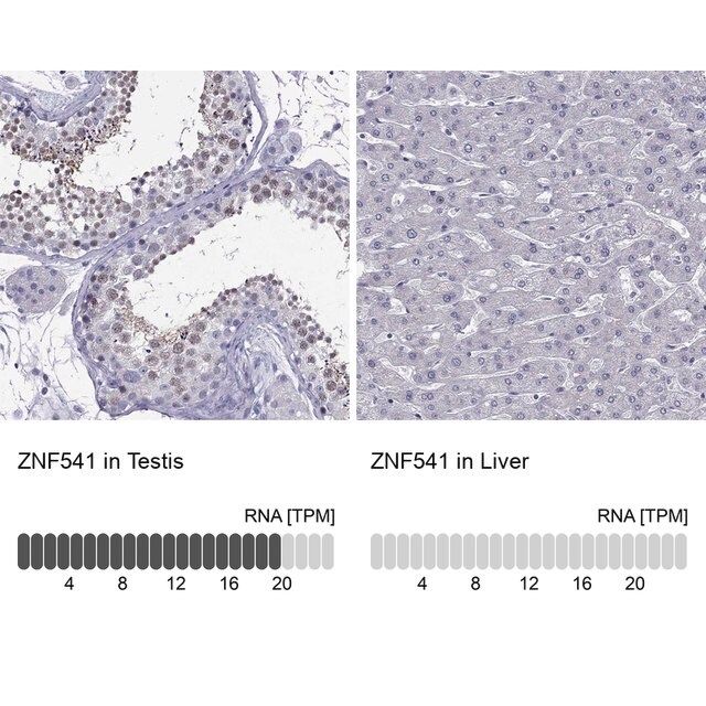 Anti-ZNF541
