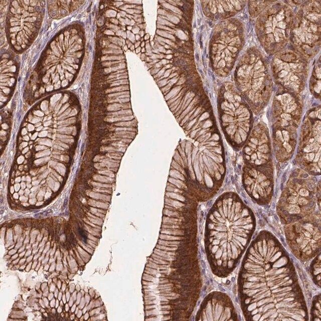 Anti-ZMYND19 antibody produced in rabbit