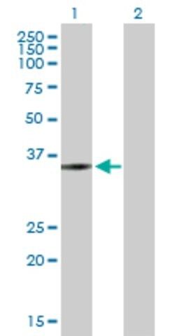 Anti-ZMYND12 antibody produced in mouse