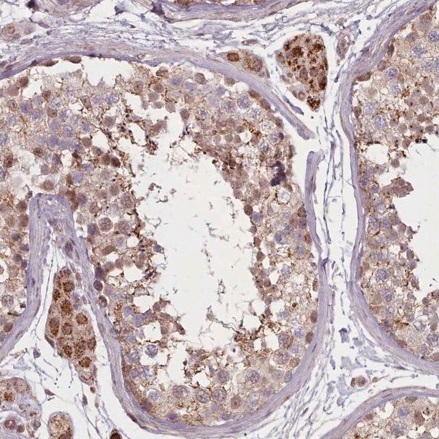 Anti-ZMYM4 antibody produced in rabbit