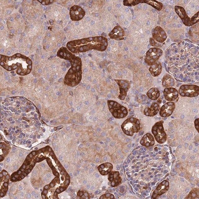Anti-ZMYM5 antibody produced in rabbit