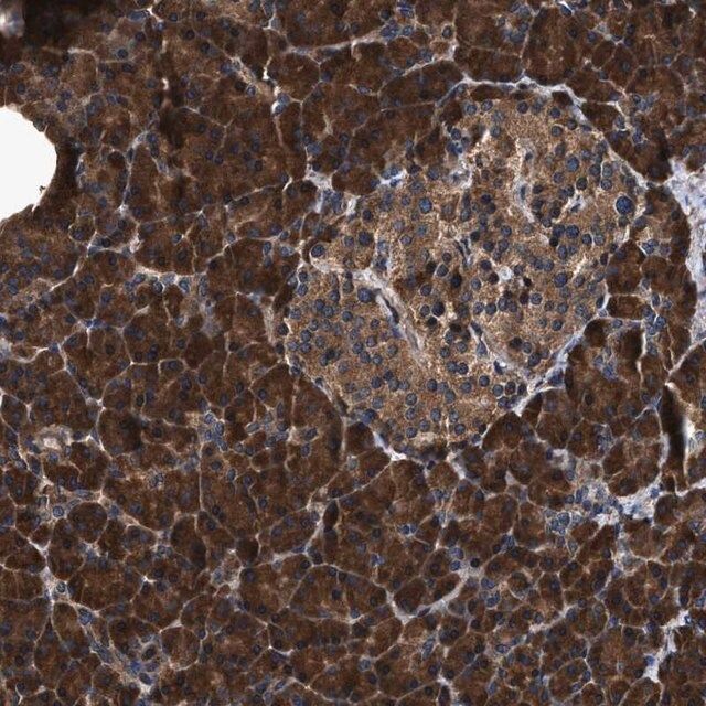 Anti-ZMYND19 antibody produced in rabbit