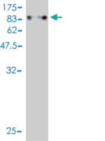 ANTI-ZNF394 antibody produced in mouse