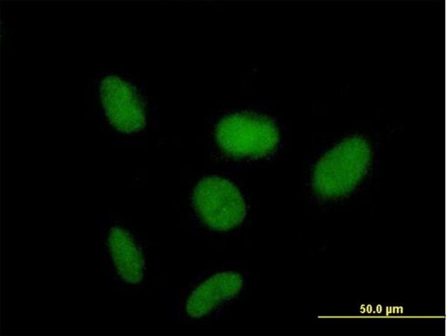 Anti-ZNF319 antibody produced in mouse