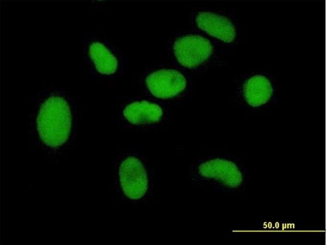 Anti-ZNF189 antibody produced in mouse