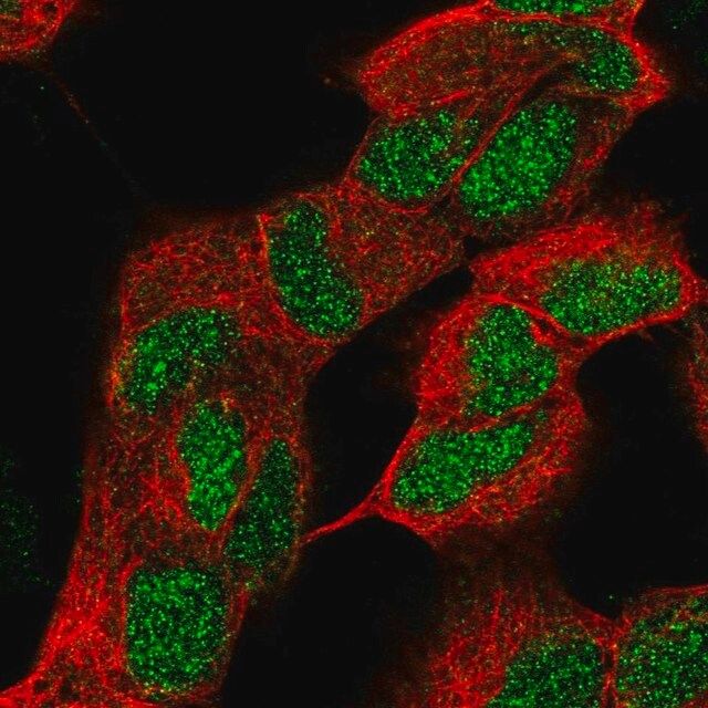 Anti-ZNF184 antibody produced in rabbit