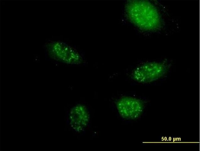Anti-ZNF501 antibody produced in mouse