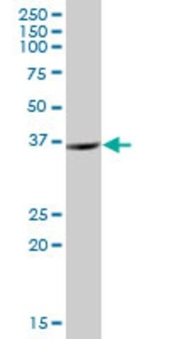 Anti-ZNF24 antibody produced in mouse