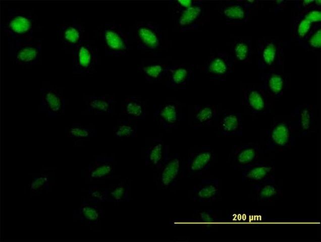 Anti-ZNF643 antibody produced in mouse
