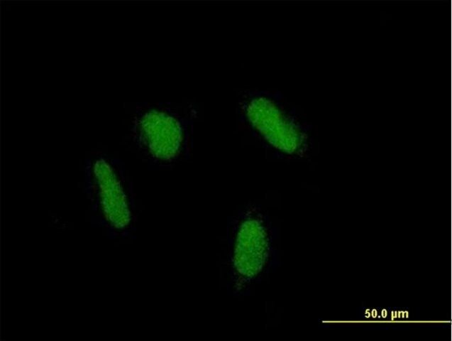Anti-ZNF436 antibody produced in mouse