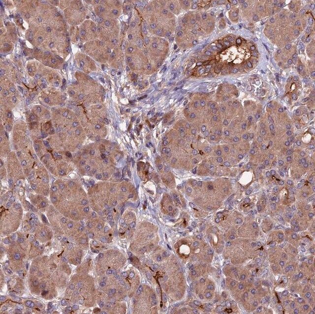 Anti-ZNF598 antibody produced in rabbit