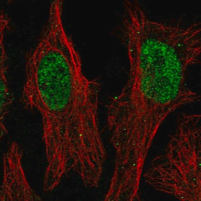 Anti-ZNF320 antibody produced in rabbit