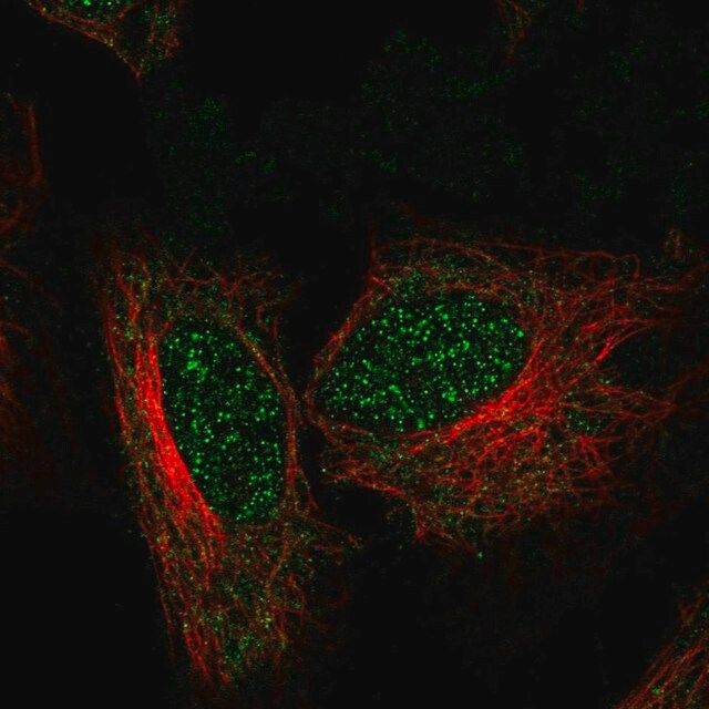 Anti-ZNF594 antibody produced in rabbit