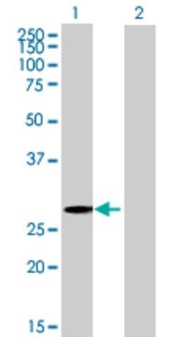 Anti-ZNF434 antibody produced in mouse