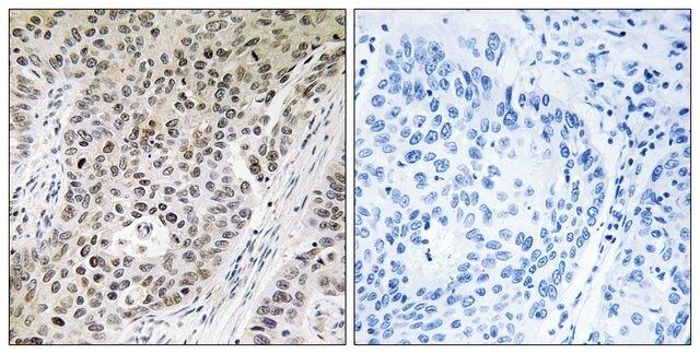Anti-ZNF608 antibody produced in rabbit
