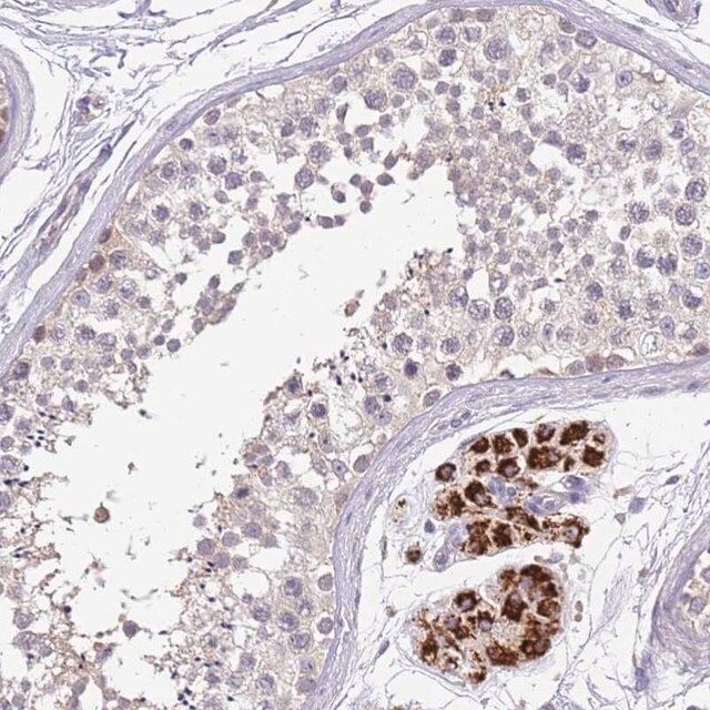 Anti-ZNF746 antibody produced in rabbit