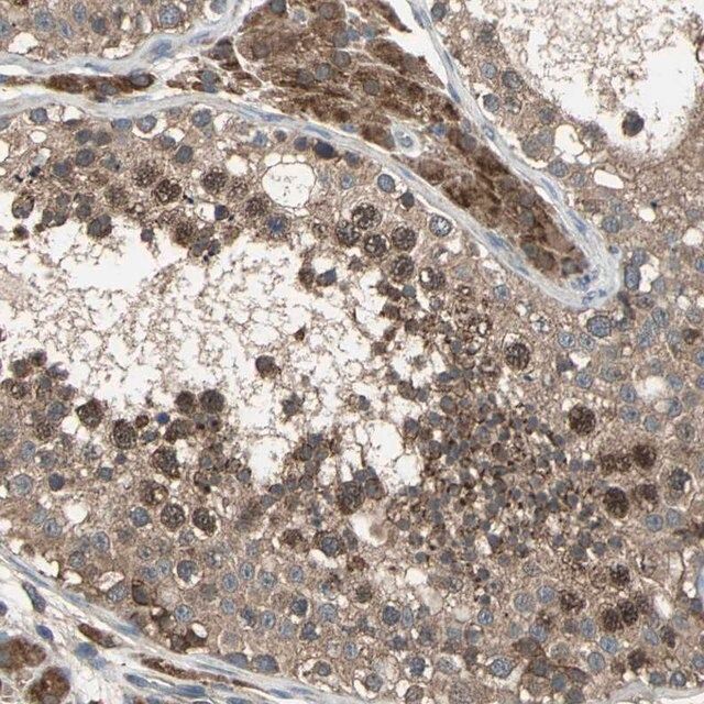 Anti-ZNF608 antibody produced in rabbit