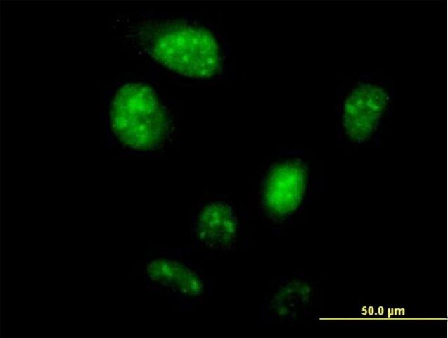 Anti-ZNF738 antibody produced in mouse