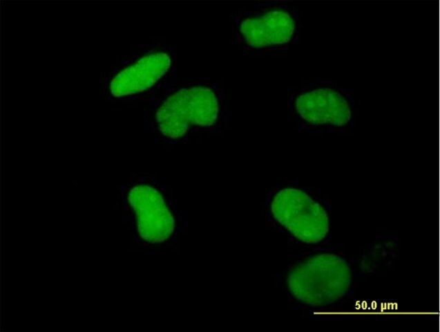 Anti-ZNF502 antibody produced in mouse