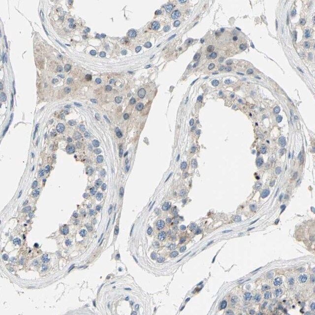 Anti-ZNF184 antibody produced in rabbit