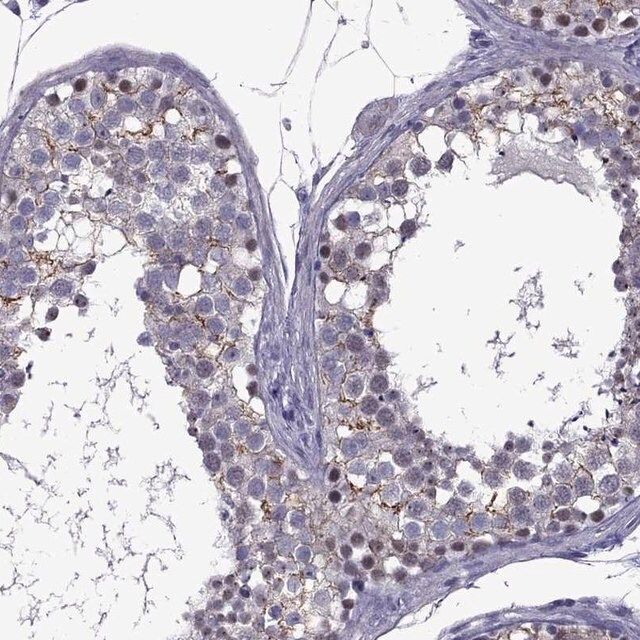 Anti-ZNF646 antibody produced in rabbit