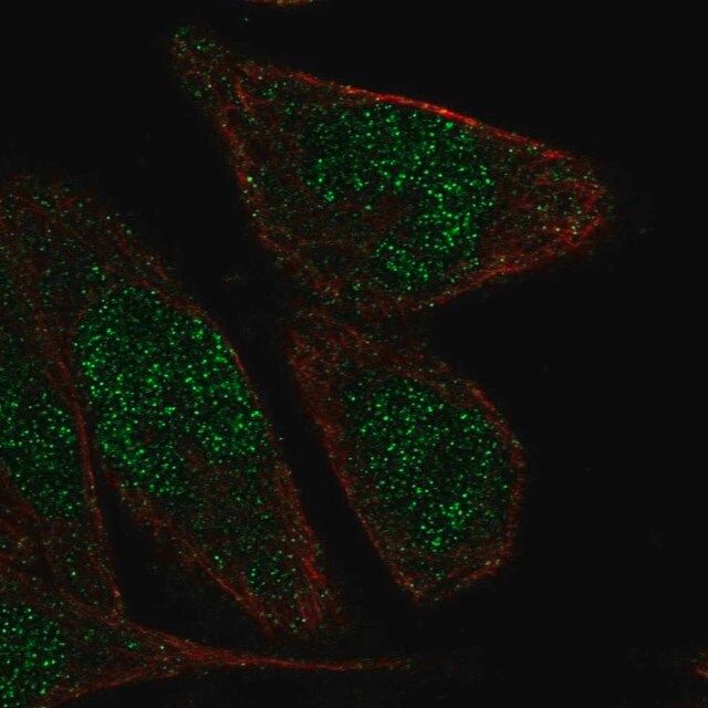 Anti-ZNF610 antibody produced in rabbit