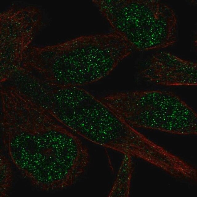 Anti-ZNF273 antibody produced in rabbit
