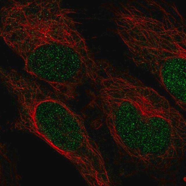 Anti-ZNF594 antibody produced in rabbit