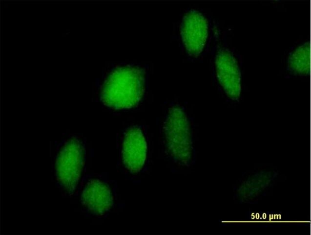 Anti-ZNF473 antibody produced in mouse