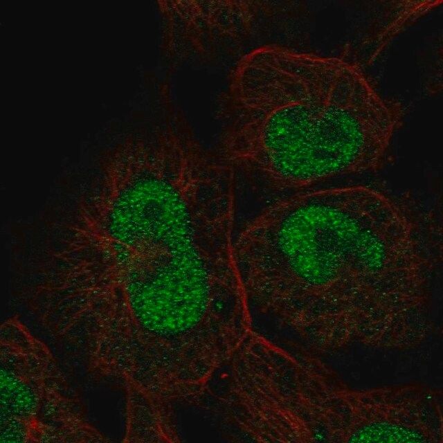 Anti-ZNF667 antibody produced in rabbit