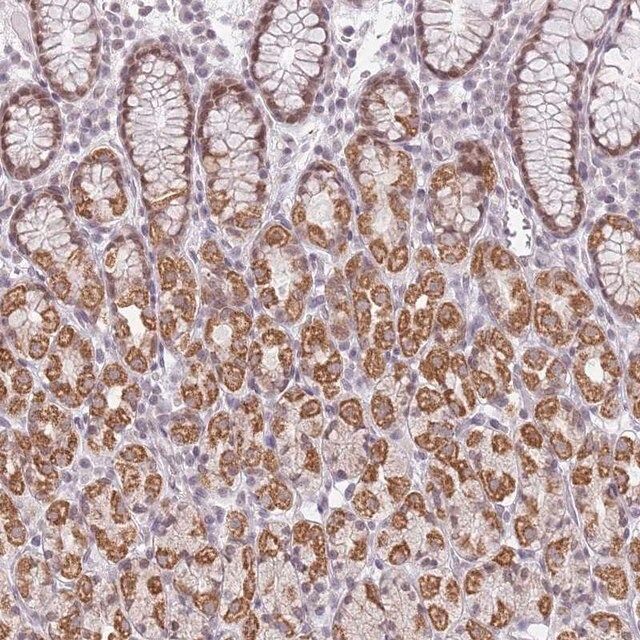 Anti-ZNF574 antibody produced in rabbit