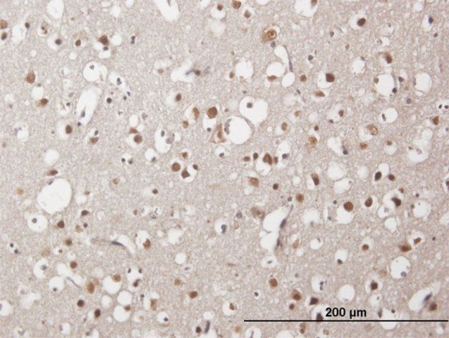 Anti-ZNF483 antibody produced in mouse