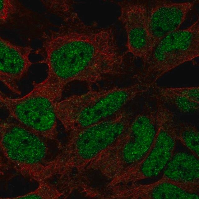 Anti-ZNF560 antibody produced in rabbit