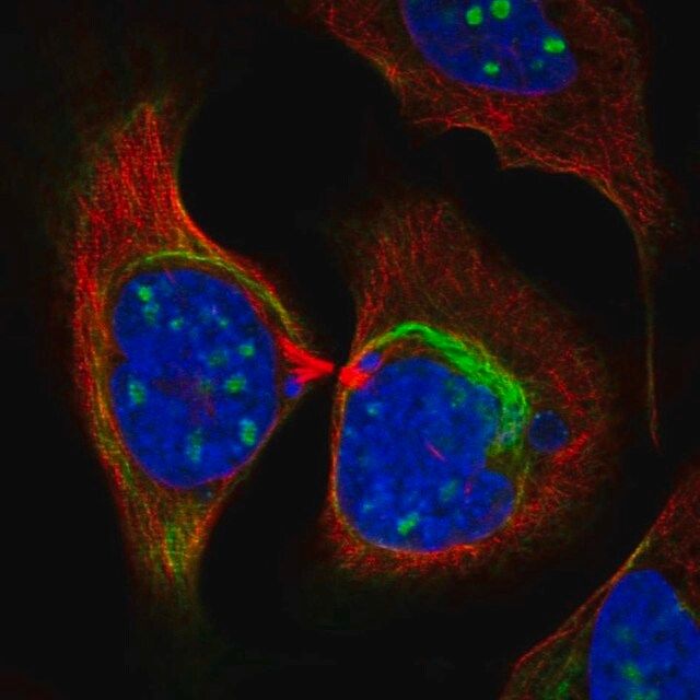 Anti-ZNF404 antibody produced in rabbit