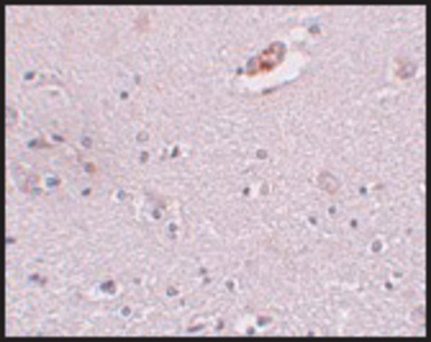 Anti-ZNF536 antibody produced in rabbit