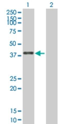 Anti-ZNF783 antibody produced in mouse