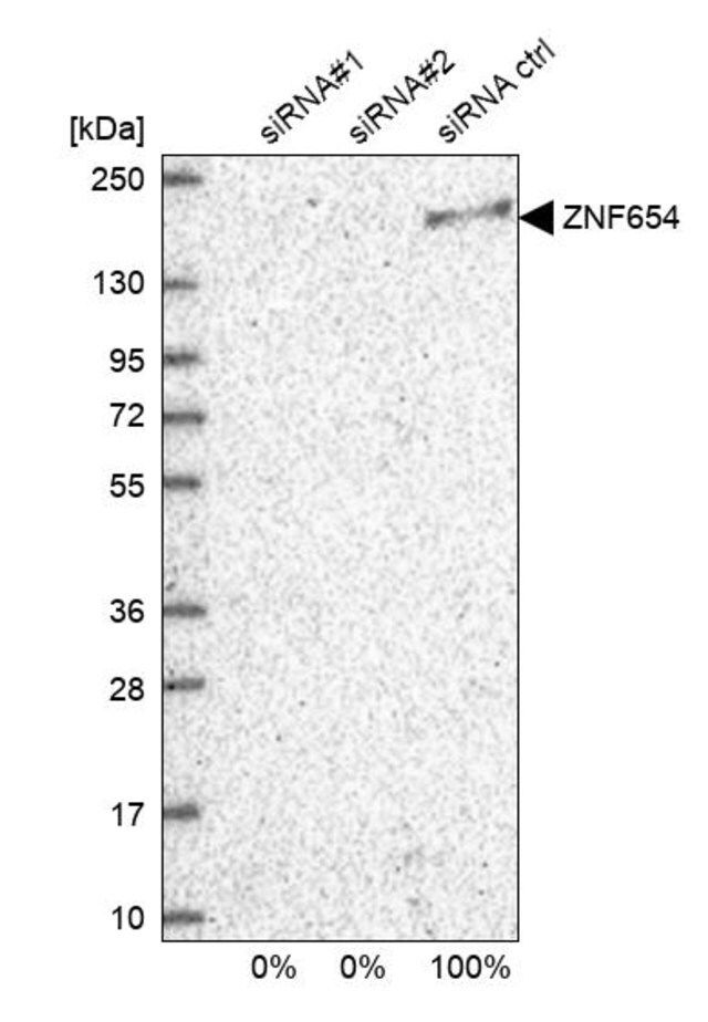 Anti-ZNF654 antibody produced in rabbit