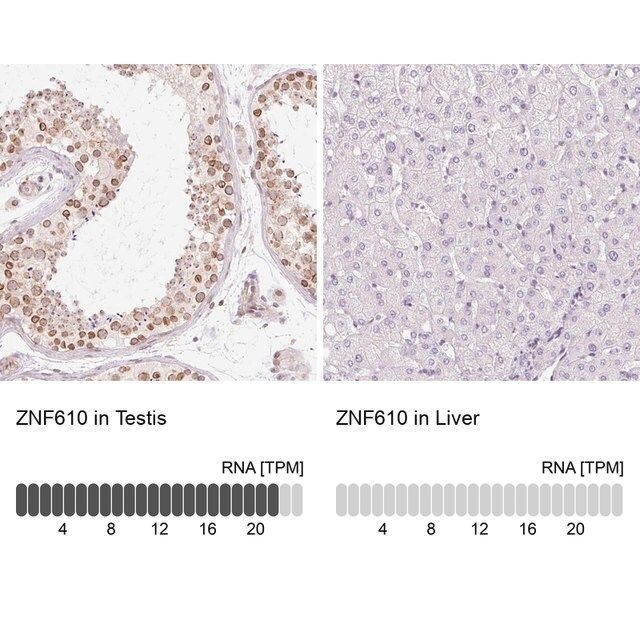 Anti-ZNF610 antibody produced in rabbit
