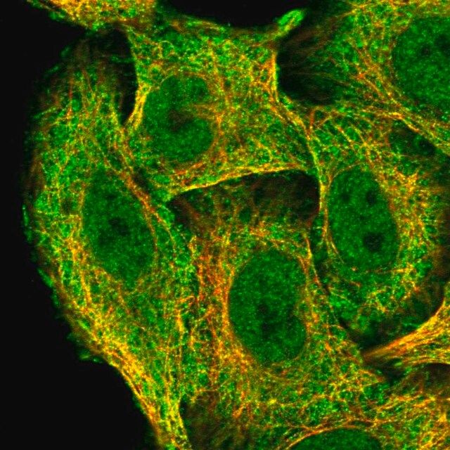 Anti-ZNF646 antibody produced in rabbit