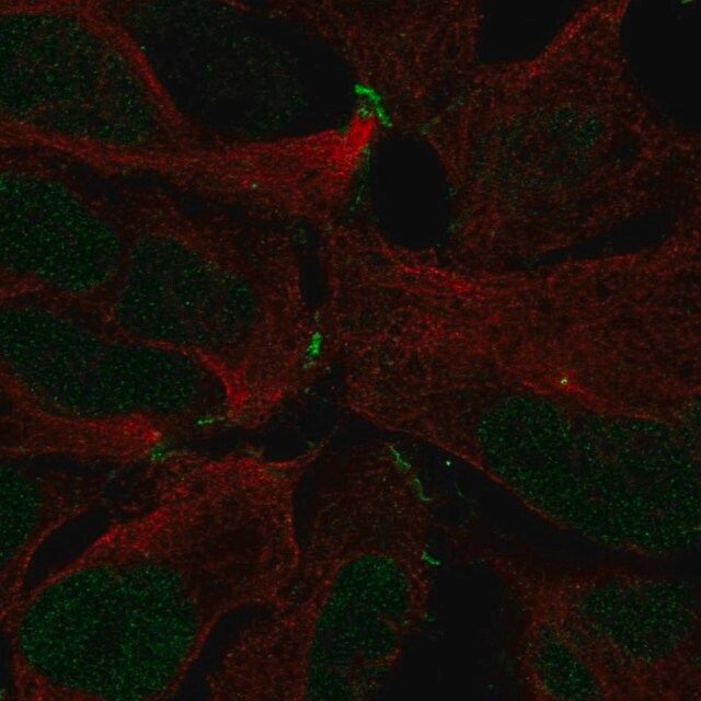 Anti-ZNF536 antibody produced in rabbit