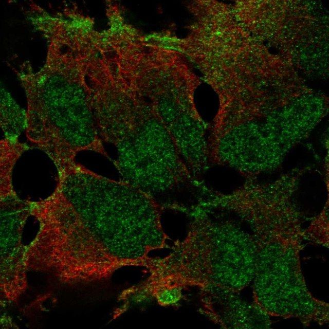 Anti-ZNF560 antibody produced in rabbit