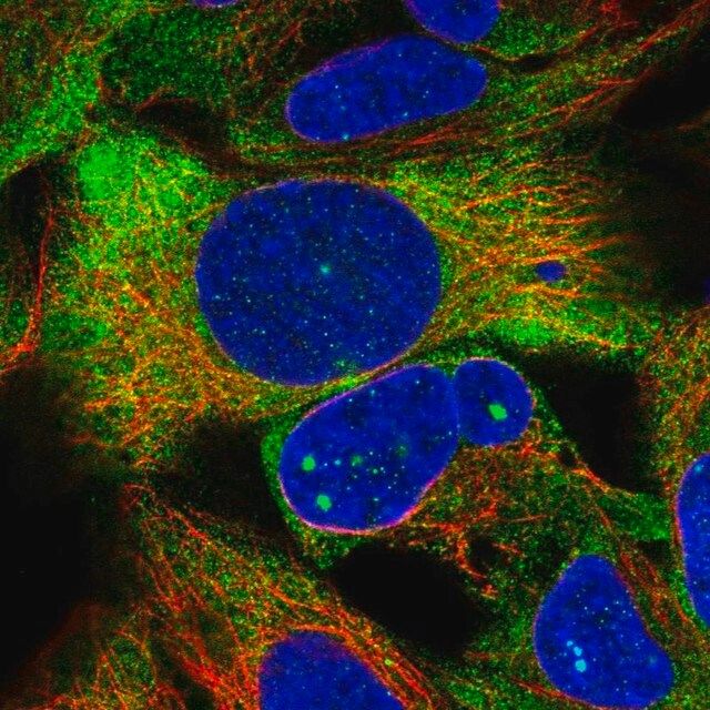 Anti-ZNF416 antibody produced in rabbit