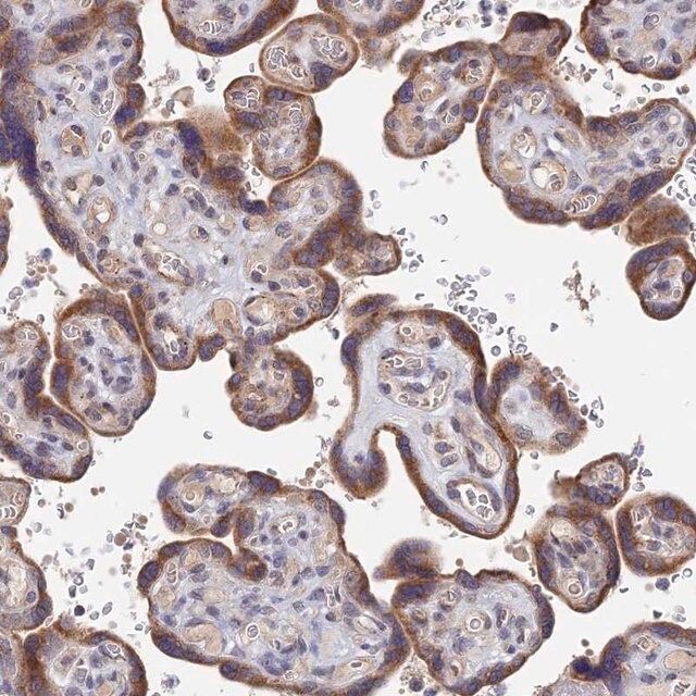 Anti-ZNF320 antibody produced in rabbit