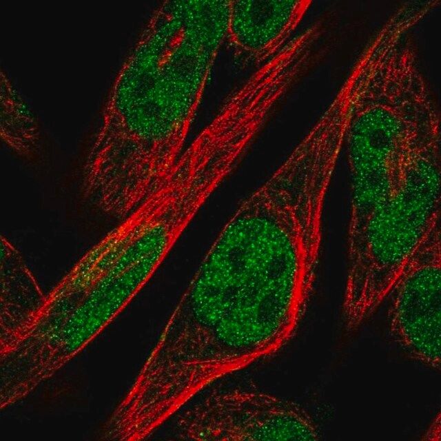 Anti-ZNF594 antibody produced in rabbit
