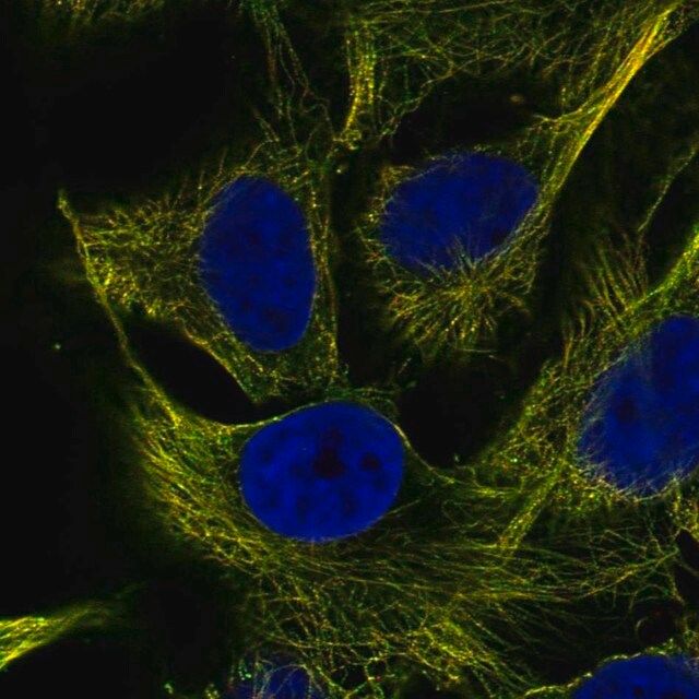 Anti-ZNF654 antibody produced in rabbit