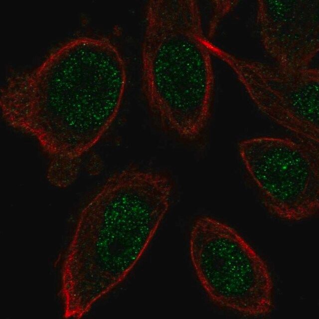 Anti-ZNF664 antibody produced in rabbit