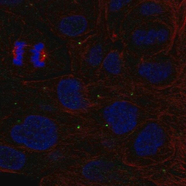 Anti-ZNF620 antibody produced in rabbit
