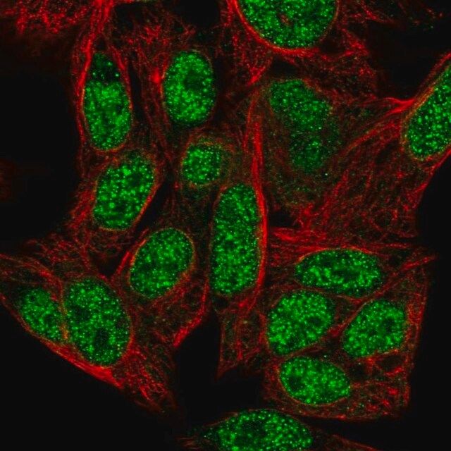 Anti-ZNF556 antibody produced in rabbit