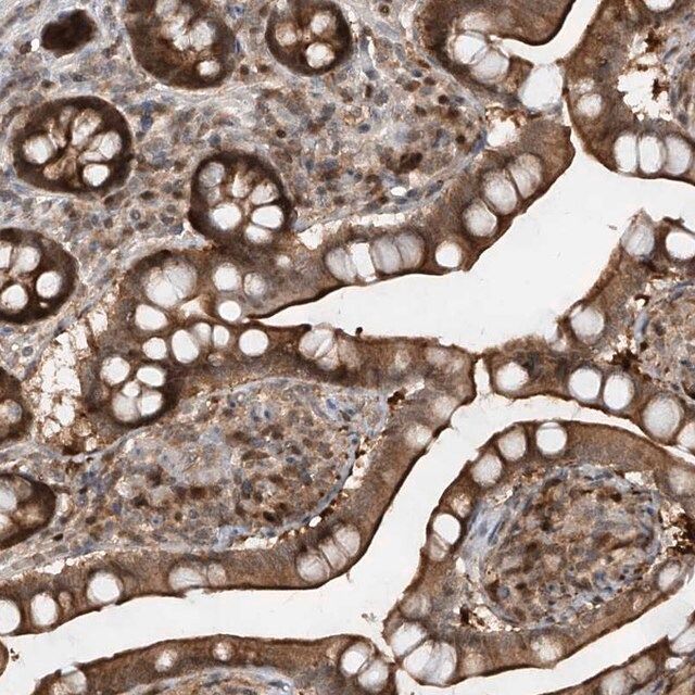 Anti-ZNF358 antibody produced in rabbit